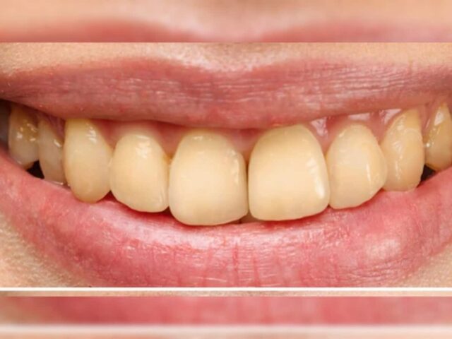 706764-yello-teeth_390135774.jpg