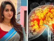 શું તમે જાણો છો માનવ લીવર વિશે આ ખાસ વાત? દીપિકા કક્કરનું લીવર 22% સડેલું હતું અને તેને કાપવું પડ્યું હતું; સારવાર શું છે?