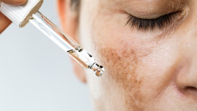 right-way-of-using-retinol_395963553.jpg