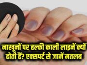 નખ પર દેખાતી આ કાળી રેખા મજાક નથી, ગંભીર બીમારીની નિશાની હોઈ શકે છે!