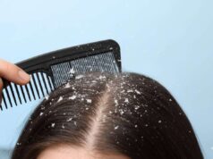 ડેન્ડ્રફ અને ખંજવાળ માટે ઘરેલું ઉપાય: દહીં વડે 3 અસરકારક હેર માસ્ક તૈયાર કરો અને રેશમી વાળ મેળવો.