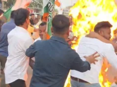 યુથ કોંગ્રેસના જિલ્લા પ્રમુખ પૂતળા દહન કરતી વખતે દાઝી ગયા… હોસ્પિટલમાં દાખલ